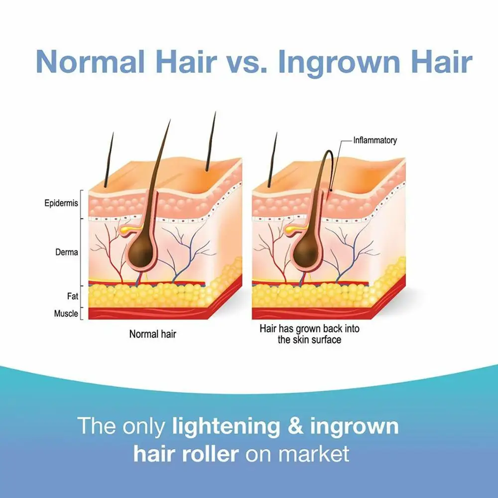 OEM After Shave Razor Bump Stopper, Waxing Skin Care Solution for Soothes Skin Prevents Ingrown Hairs with Dark Spots Removal