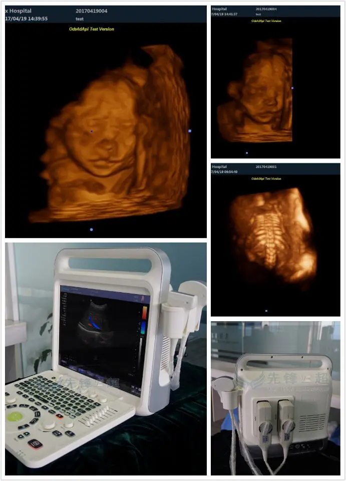 SZMIQU 15 дюймов HD дисплей ноутбук цветной многоязычный Портативный Цветной Допплер ультразвуковой допплер 3D 4D