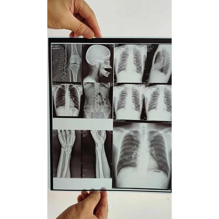 Agfa X-Ray Film 10x12in Dt2b 25x30cm Drystar Medical Imager Printer Film