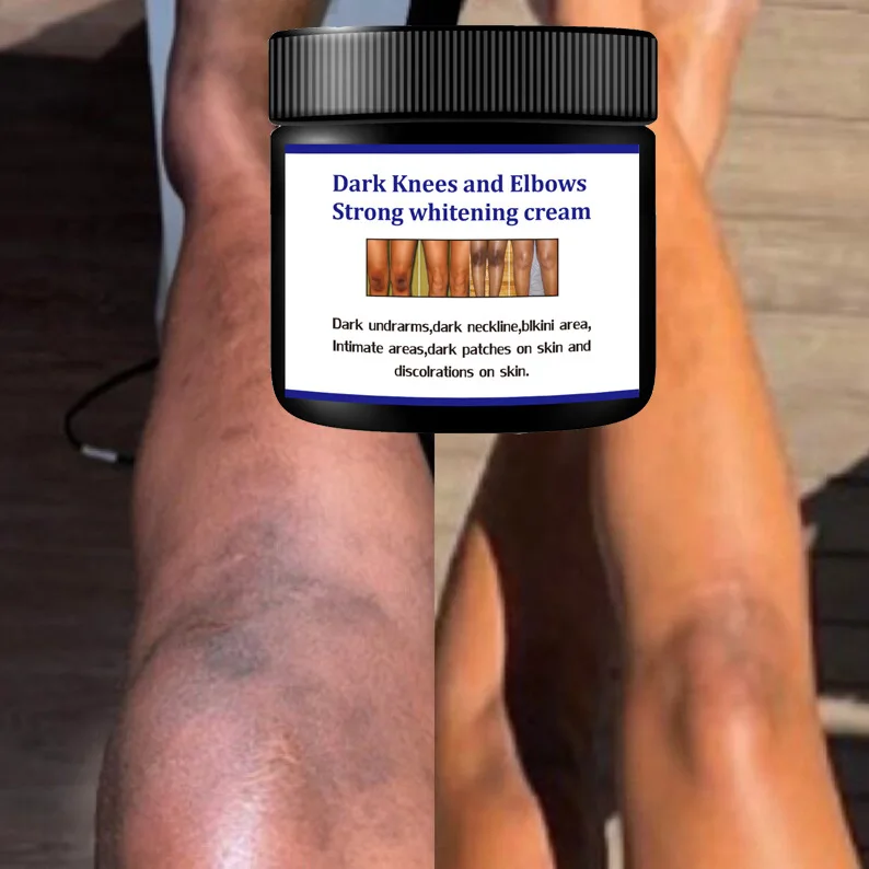 Best Selling Dark Spot Corrector Remover Private Label Skin Care Serum Whitening Freckle Bleaching Cream for Dark Skin