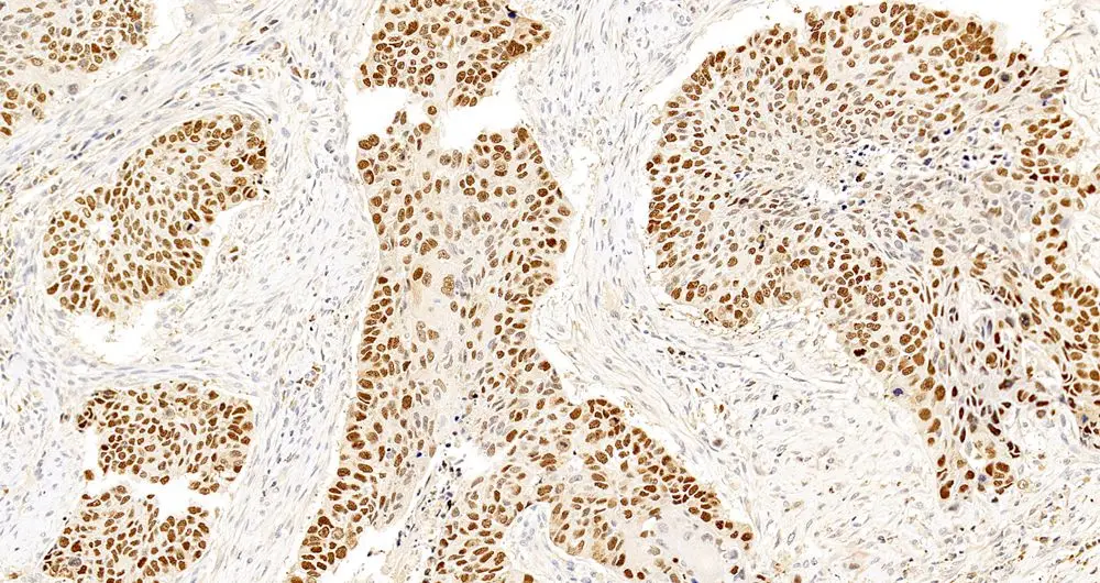 Primary Antibodies Polyclonal Antibody Anti-p53 Rabbit biotechnology laboratory