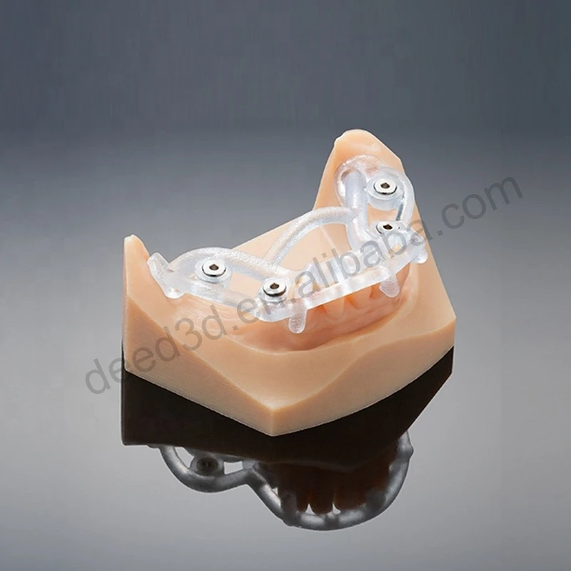 Polyjet индивидуальная полимерная Стоматологическая модель 3d-печать