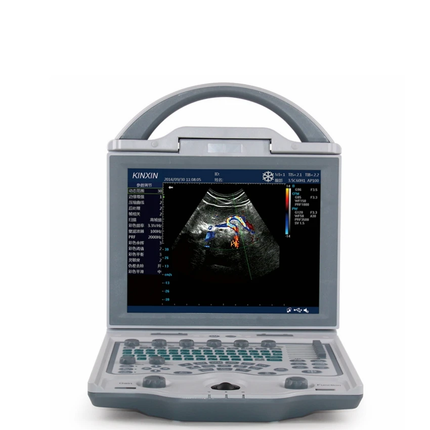 Портативный цветной эхолот-аппарат для измерения и анализа гинекологии