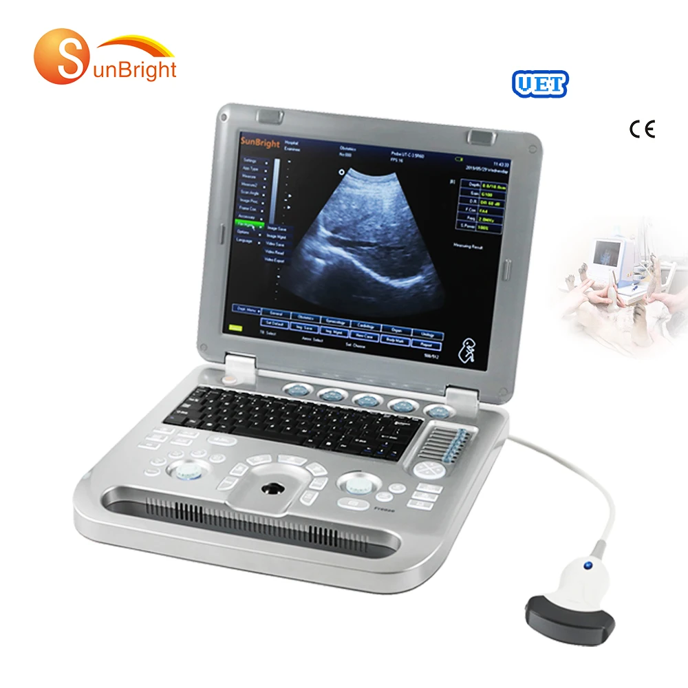 SUN-800D Manufacturer Hospital device Ultrasound Machine 3D diagnostic Scanner ecografo portatil Laptop BW Vet ultrasound