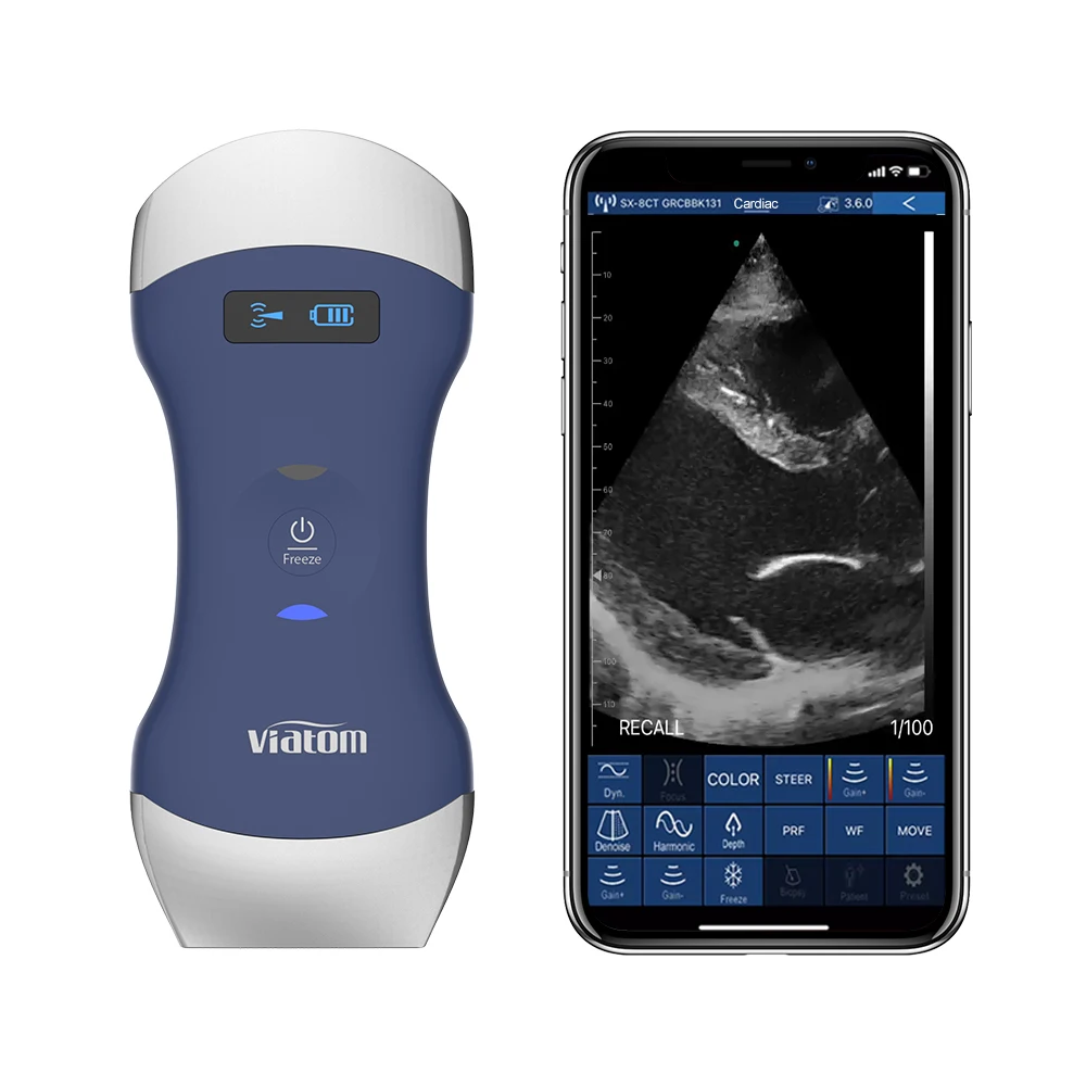 Viatom Wireless Portable Human Ultrasound Machine High Quality Medical Machine Ultrasound Probe