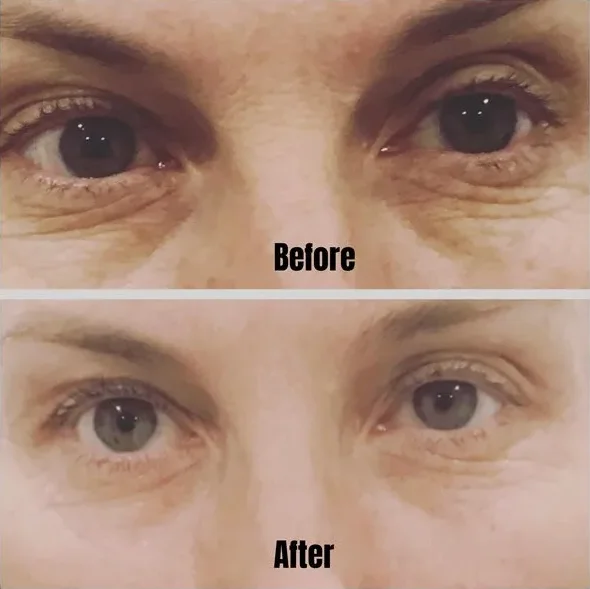 2023 Top Sale Korean Skin Care Eye Cream for Dark Circles and Puffiness Treatment