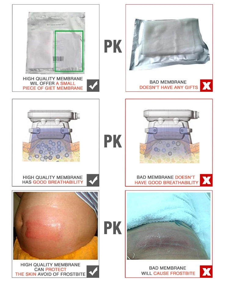 Consumable Membrane Gel Pad Anti Freeze Membranes 60g 70g 110g For Cryolipolyse