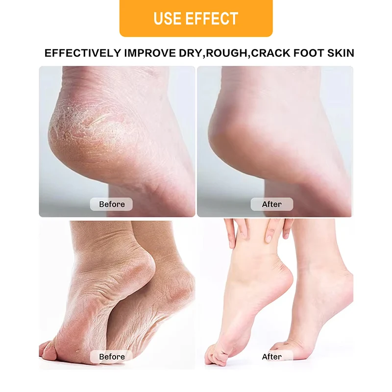 Foot Care and Repair Set with Crystal Foot Bath Scrub to Improve Dryness and Moisturize Foot Care Set