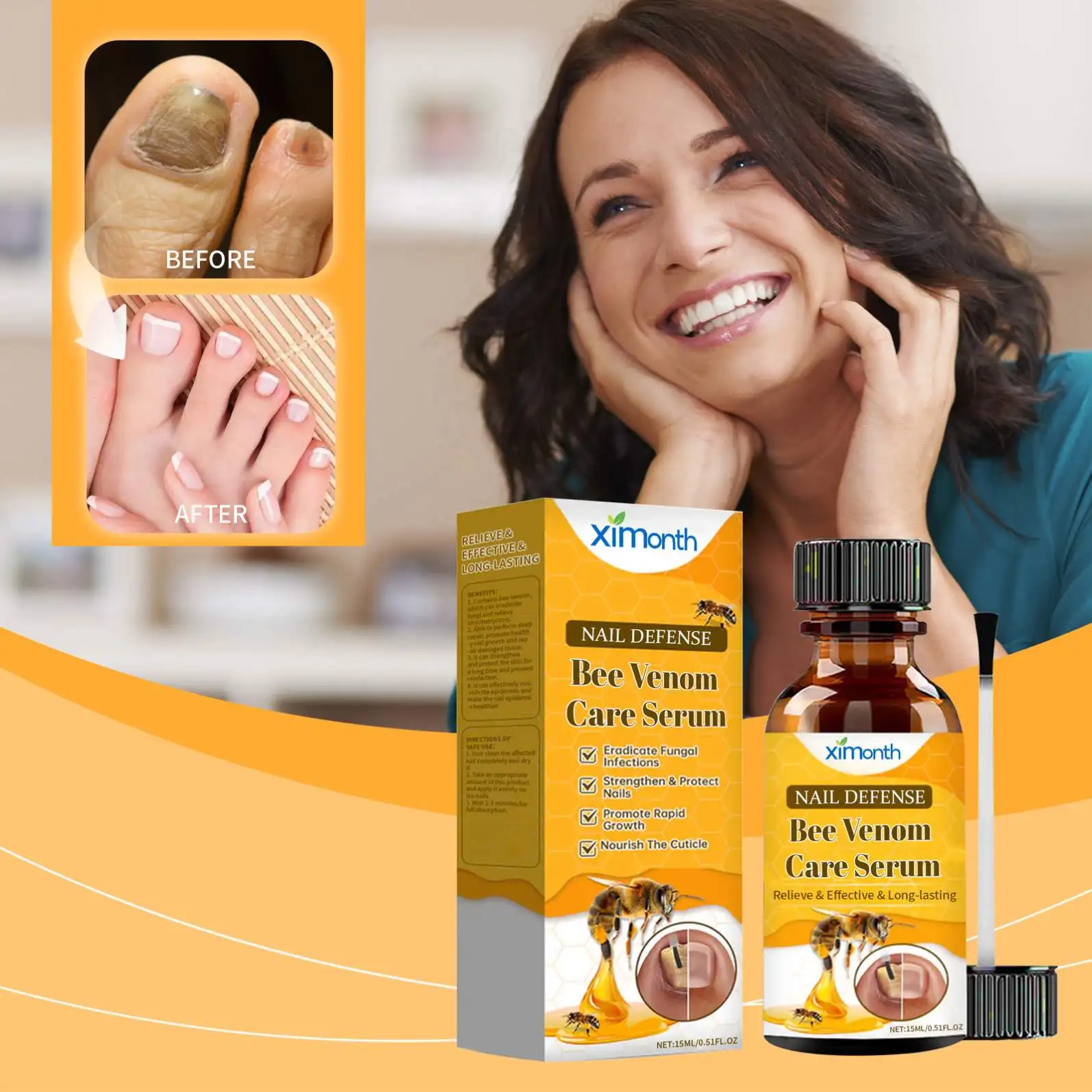 XIMONTH Wholesale Natural Herbal Bee Venom Foot Hand Toe Nail Fungus Anti Treatment Liquid Serum Essence 15ML