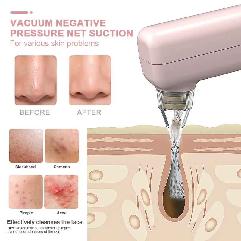 Hot Selling Electric Vacuum Blackhead Remover Facial Pore Acne Deep Cleaning Comedone Zit Pimple Extractor Tool with Camera