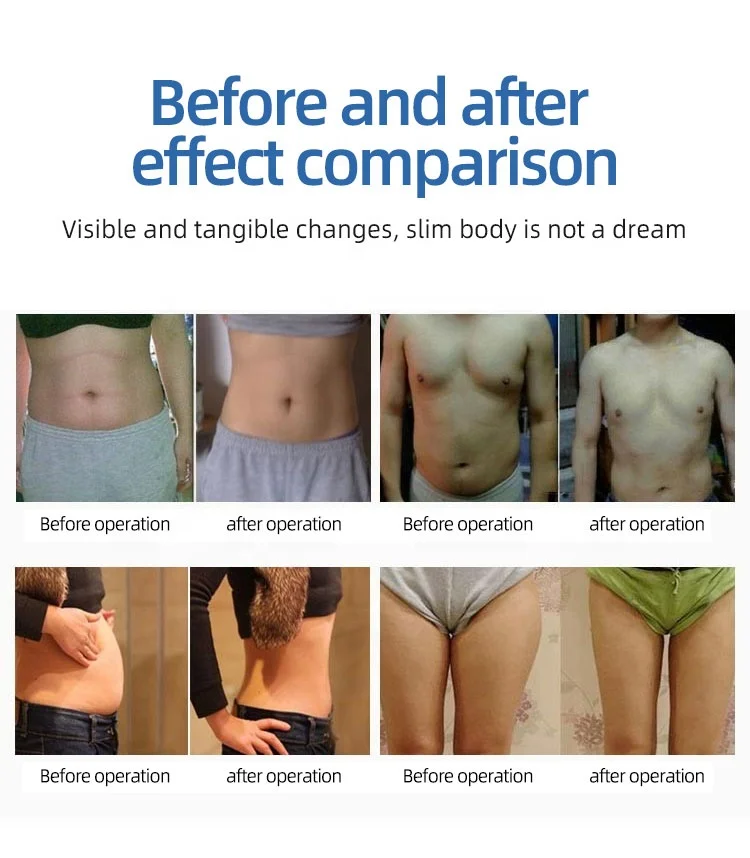 Оптовая продажа, липосакционный лазер, 6 в 1, 80 К, кавитационный липосакционный лазер для похудения, ультразвуковая липосакционная лазерная машина