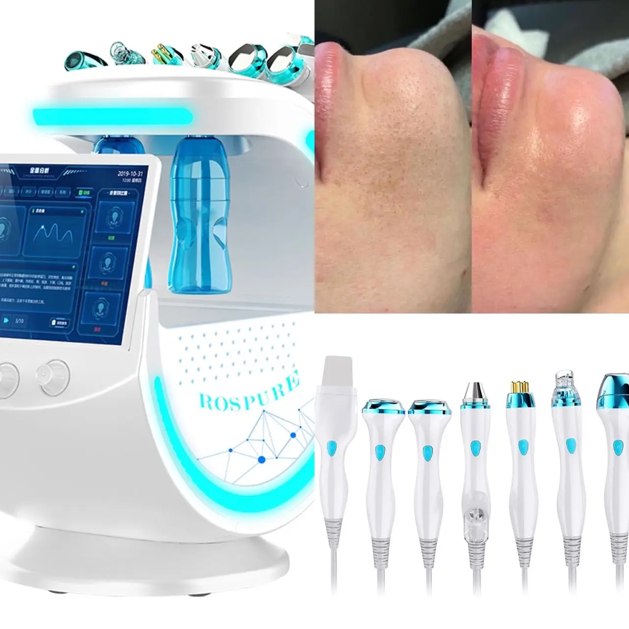 7 in 1 Microdermabrasion Oxygen Jet Aqua Facial Deep Cleaning Skin Beauty Equipment