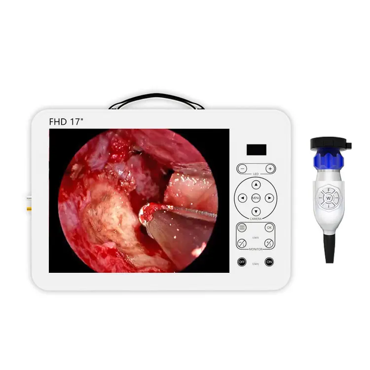 medical Hot sale shrek endoscopy unit gw 617 camera nose endoscopic equipment