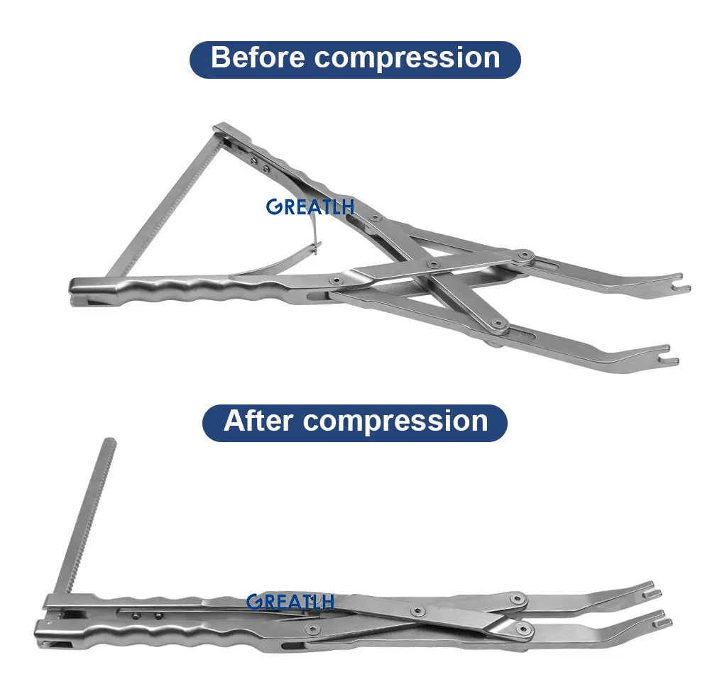Orthopedic surgical Instrument Orthopedic Pliers medical Forceps surgical Pliers