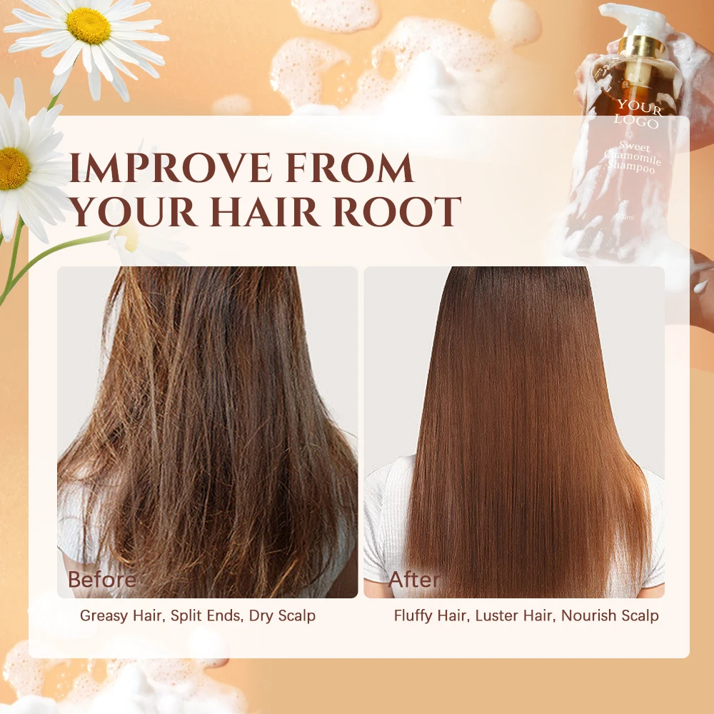 Private Label Sulphate Free Clarifying Moisturizing Anti Dandruff Fluffy Sweet Chamomile Shampoo