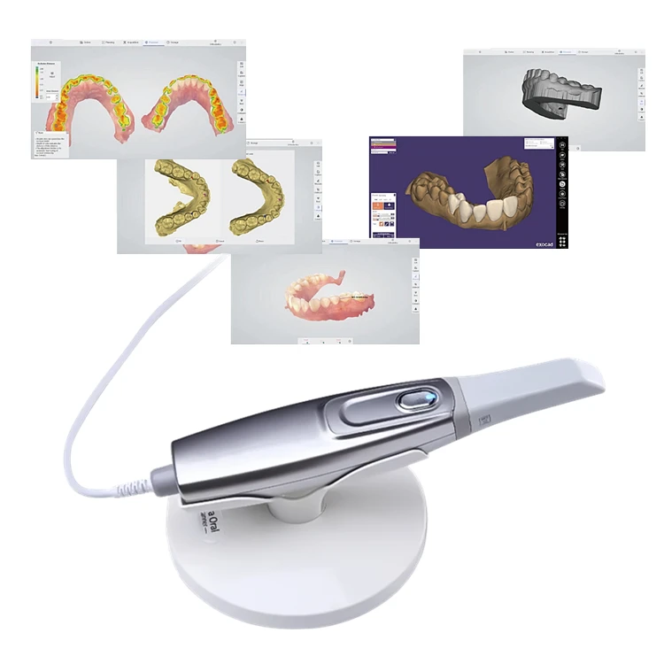 Portable High Speed dental Oral Scanner Digital S3 Performance 90 Seconds Full Arch True Color dental Intraoral Scanner