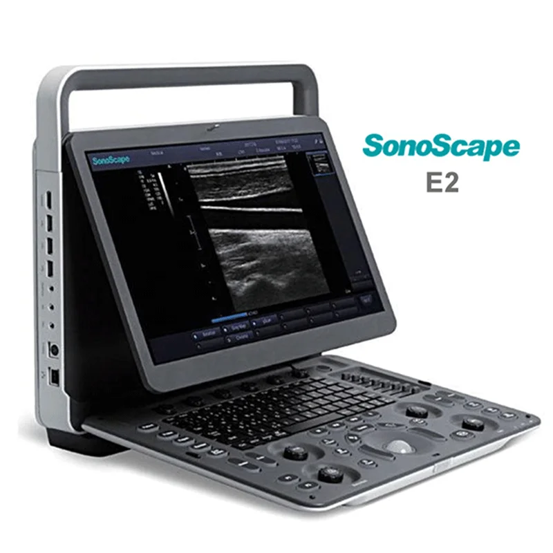 Sonoscape E2 color doppler ultrasound machine medical ultrasound instruments portable ultrasound scanner