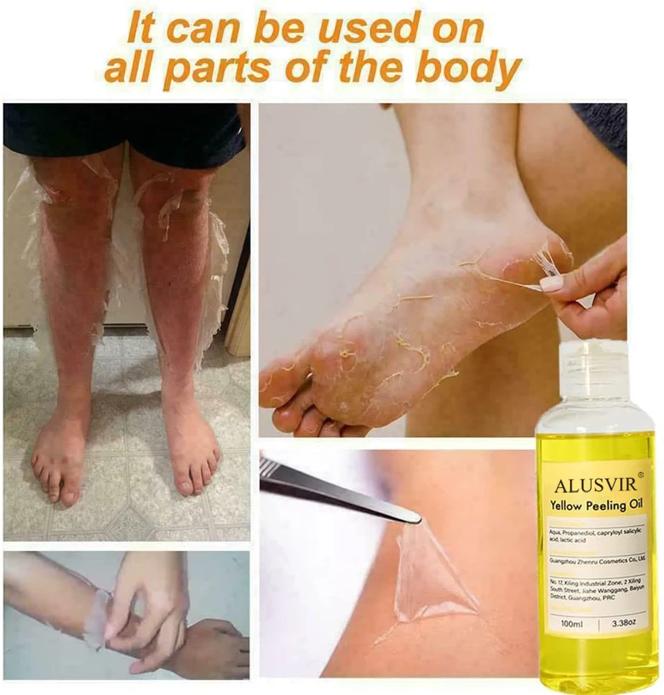 Private Label Yellow Peeling Oil Yellow Extra Strong Whitening  Exfoliating Bleaching Dark Skin Peeling Oil