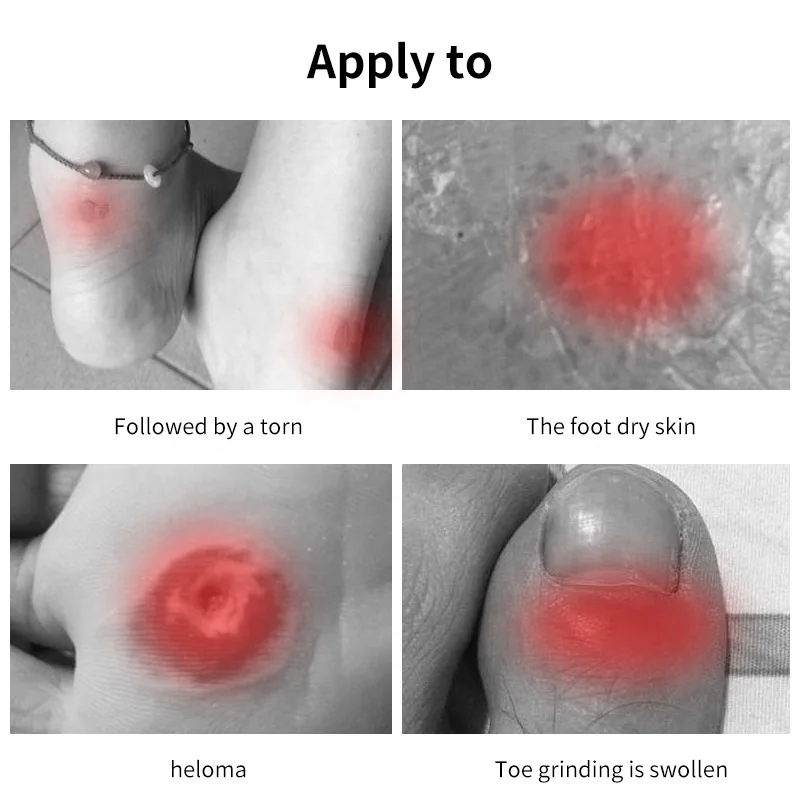 Tape Latex Adhesive Pads Heel Stickers Blister Prevention Anti-wear Heel Pads for Feet Fabric Padding