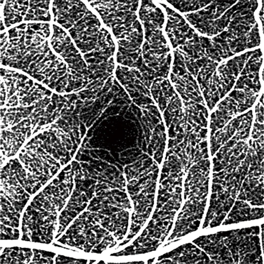 Latest  Optical Coherence Tomography Scanner Eye Examination Ophthalmic Optical Equipments fundus camera