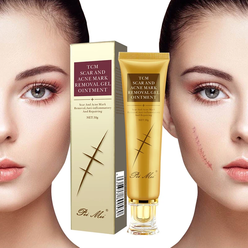 Light Print Scars Removal Face Cream Beauty Pure Skin Care Whitening Facial Moisturizing Acne Treatment Face Burn Scar Removal C