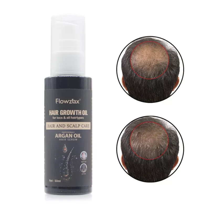 Private Label Natural Organic Vegan Treatment for Baldness Hair Growth Essential Oil Herbal Anti-Hair Loss Hair Growth Oil