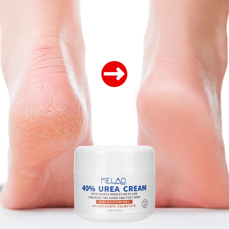Private Label Repairing Foot Cream Dry Skin Moisturize Feet Softening Herbal Callus 40% Urea Hand Lotion Antifungal Skin Care