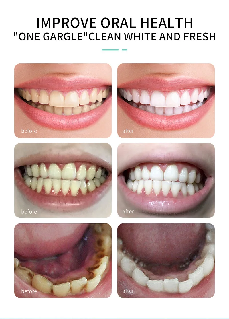 Customized OEM Factory 2 Coconut Oil Mouthwash Oil Pulling Mouthwash  Cleaning Gums Mouthwash