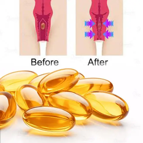 Оптовая продажа индивидуальные 3 года 100% натуральная травяная частная капсула Yoni вагинальная сжимаемая