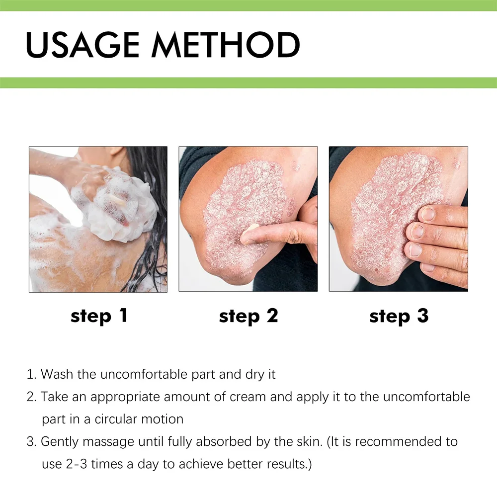 ZB Psoriasis Cream Chinese Herbal Anti-fungel Ointment Dermatitis Eczematoid Eczema Anti-itch Balm 50g