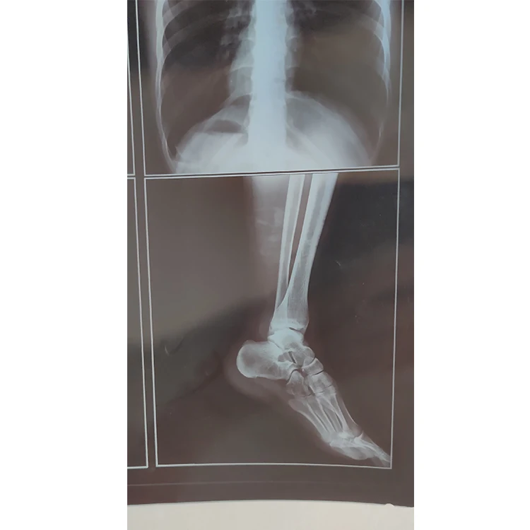 
medical dry imaging film DI-HT 