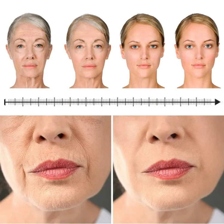 Salmon Roe Extract Hyaluronic Ampoules Peptide Moisturizing Anti-aging Serum