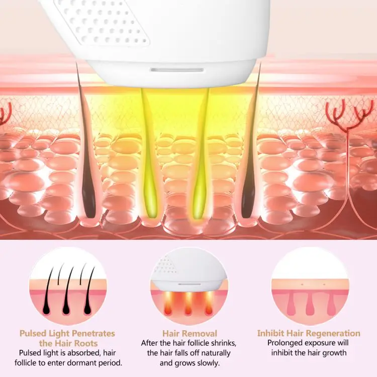 Professional Home Use IPL Hair Removal Laser Machine Skin Rejuvenation Featur  Permanent Laser Hair Removal Appliances Device