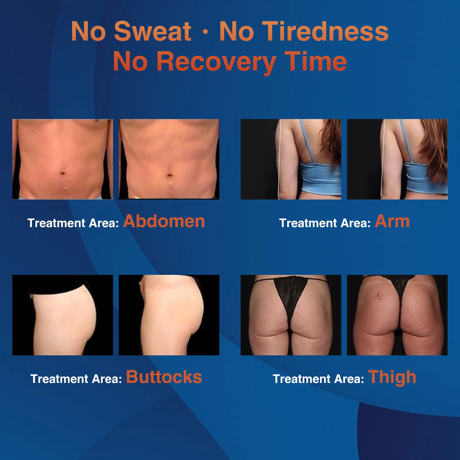 2024 Emt Emslim Body Sculpting Machine 7 Tesla Single Handles Emslim Nova Rf Professional Ems Muscle Stimulator Machine