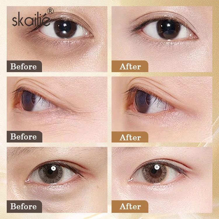 Private Label  Natural Organic Eye Lift Serum Anti Aging Anti Wrinkle Reduce Dark Circles Roller Eye Essence Oil