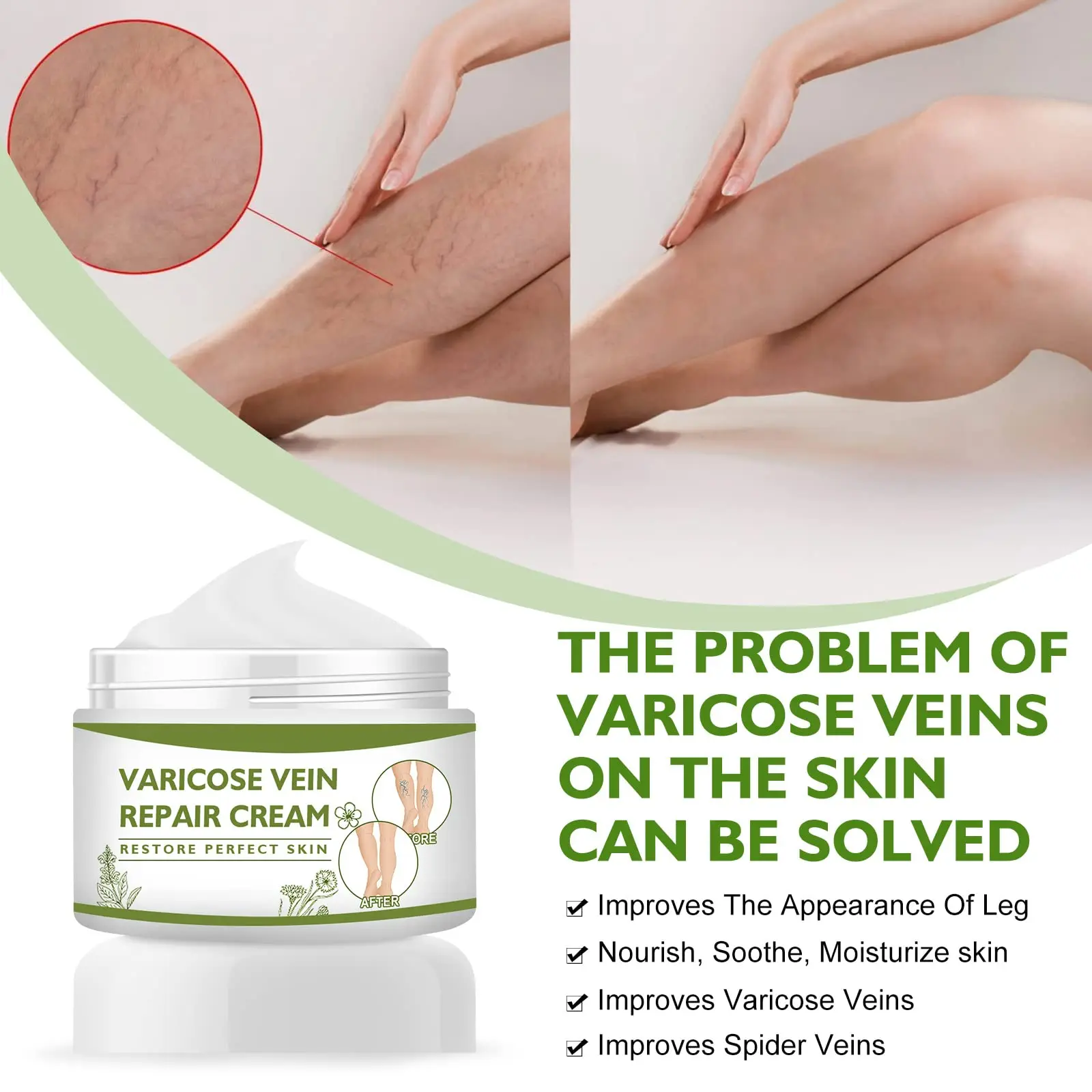Amazon Best Seller Varicose Veins Cream to Relief Veins Pain and Heavy Tired Leg Spider Varicose Vein Treatment Cream For Legs