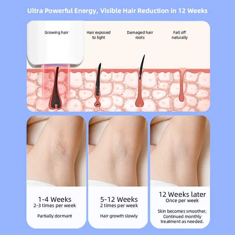 510K IPL Hair Removal Device Ice Cooling With Skin Rejuvenation Head Ipl Laser Home Hair Removal Epilator At Home