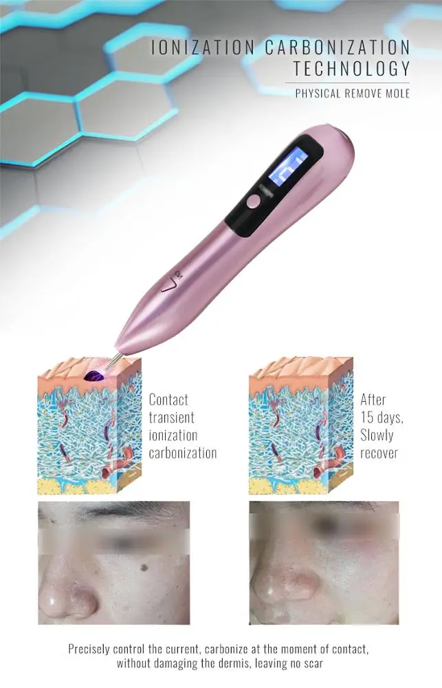 9 режимов миниатюрный ЖК-дисплей плазменная ручка для удаления пятен и родинок на