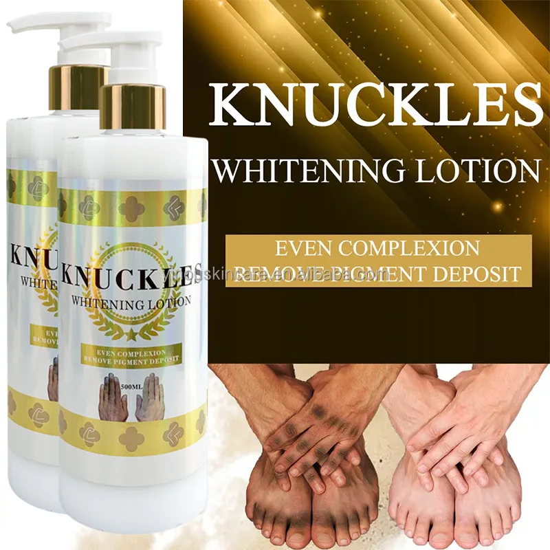 Private Label Knuckles And Toes Elbow Joints And Knees Whitening Dark Spot Removal Cream Whiting Lotion For Black Skin