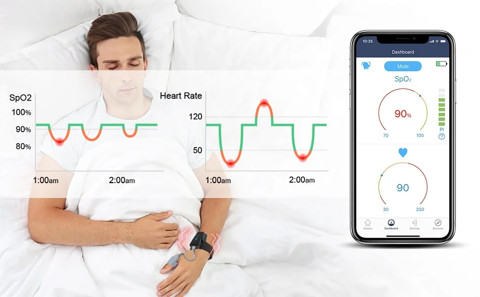 Wellue Checkme O2 Max Rechargeable Pulse Oximeter Heart Rate Variability Monitor Sleep Apnea Monitor