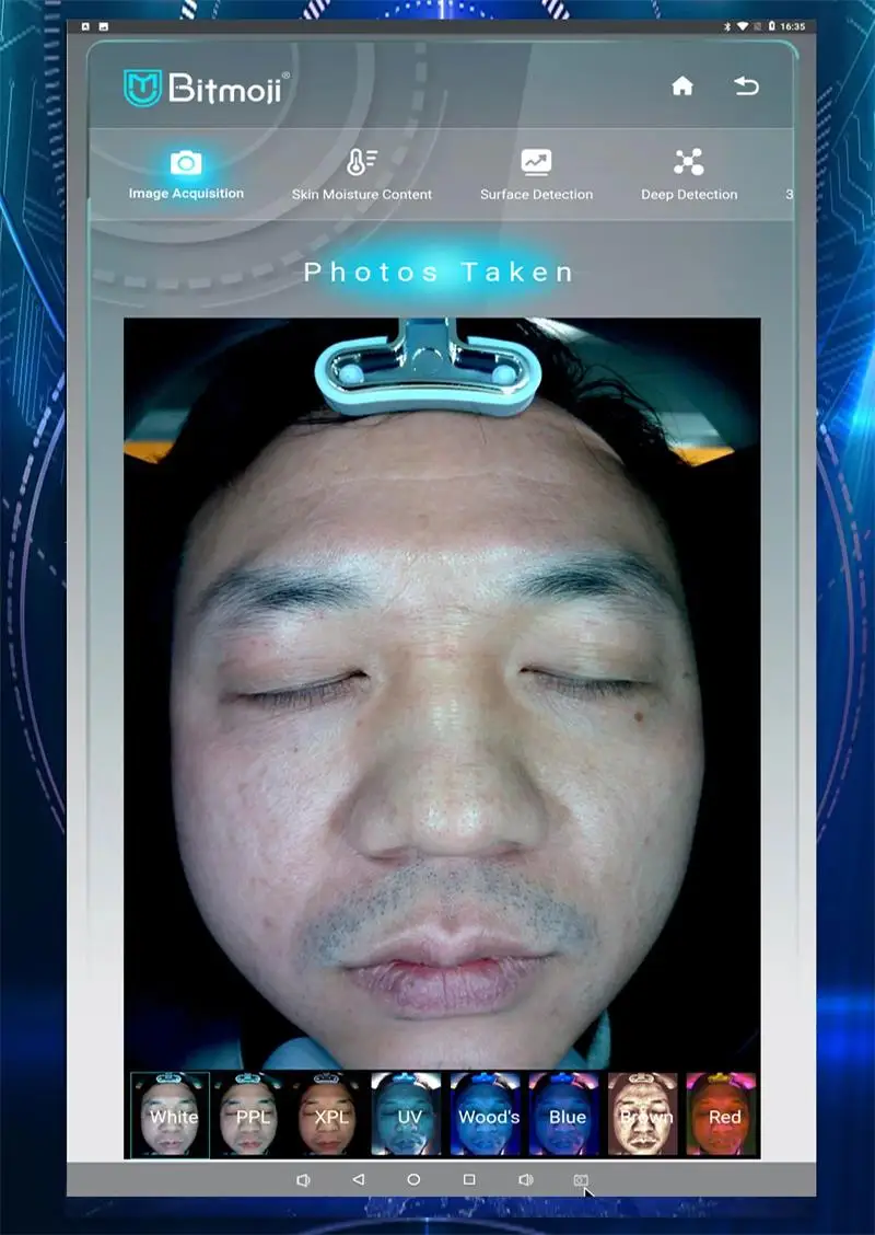 3D Skin Analyer (2).jpg