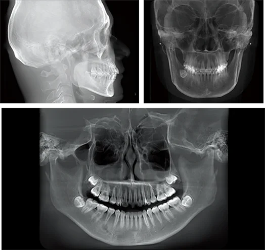 Hospital Dental Equipment Intelligent 3D CBCT Panoramic Imaging Machine Dental X-ray Machine