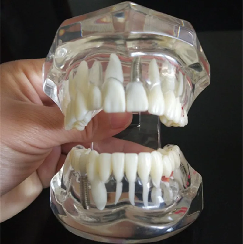 teeth can be removable dental activity pathological model teeth model