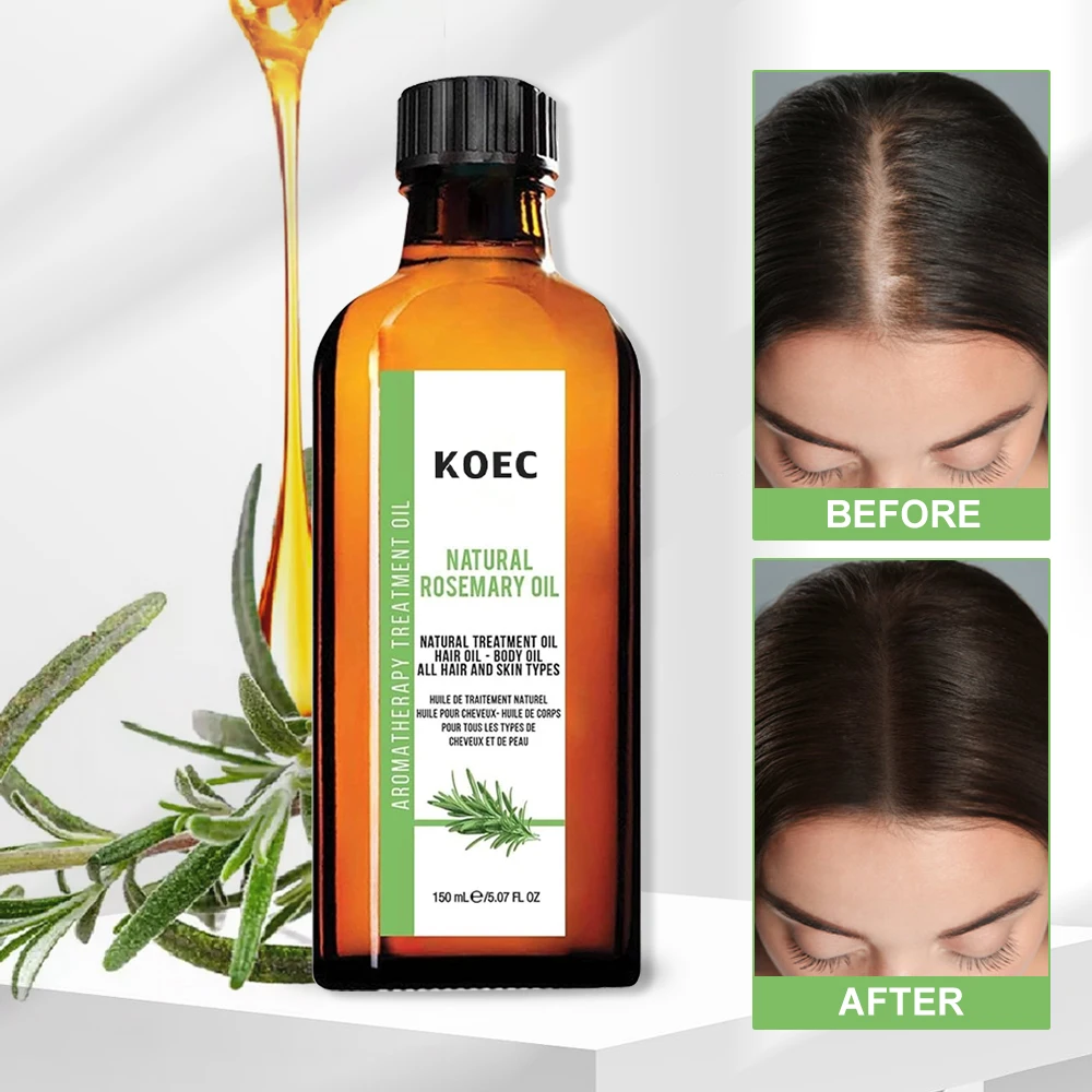 OEM  Organic Formula Fast Strengthening Women Black Hair Care Natural Rosemary Oil Hair Growth Hair Essential Oil private label