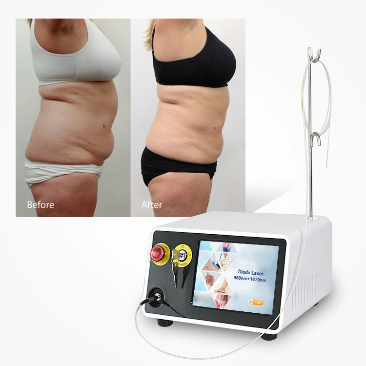 Medical Surgery Lipo Laser Device 980 1470nm Diode Laser Firming Face Endolaser Body Shaping Liposuction Machine