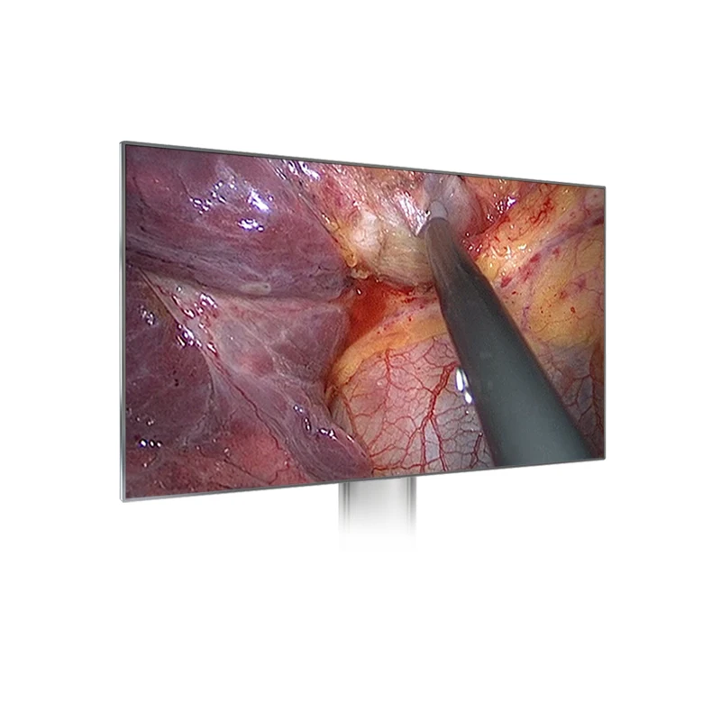 Whosale hd medical endoscope camera with cold light source for ent