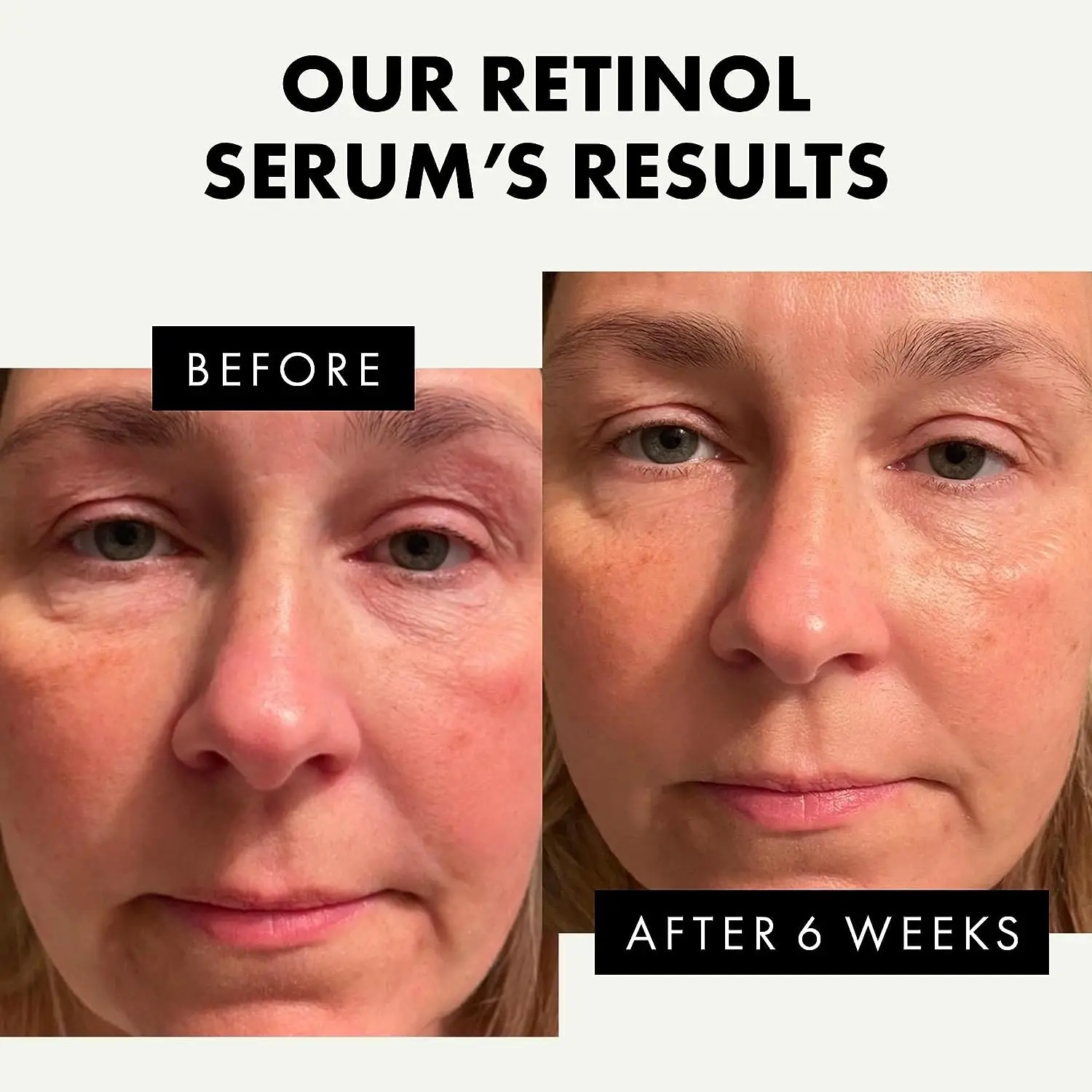Private Label 2023 Top seller 2.5% Pure Retinol Anti Wrinkle Serum with Hyaluronic Acid Vitamin B3 collagen or Face Anti Aging