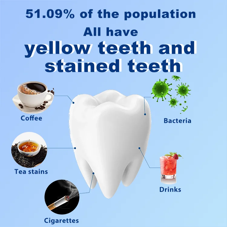 1.2 Ml Multi-Flavor Non Peroxide 16% 35%CP Carbamide Peroxide Cost-Effective Laser Teeth Whitening Gel