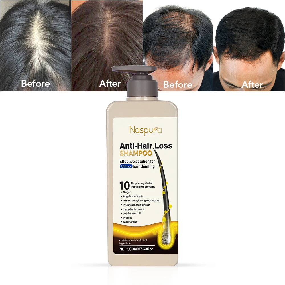 Thailand Wholesale Natural Ginger Shampoo Hair Regrowth Active Ingredients Hair Shampoo