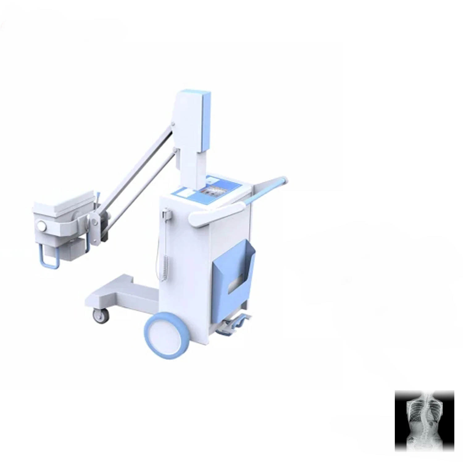 High Frequency 150MA X ray Mobile Machine with panel Laptop Software with  X-ray generator for Imaging